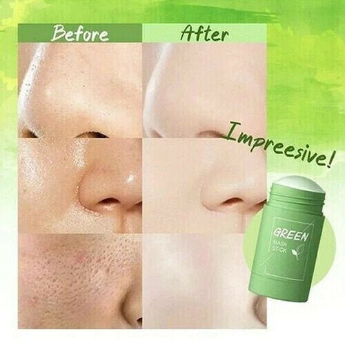 GREEN TEA CLAY STICK FACE MASK FOR ACNE, BLACK HEADS & CLEANING PORES - Image 6