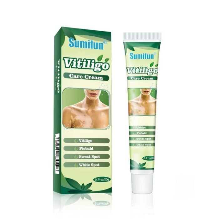 Vitiligo Treatment Cream White Spot