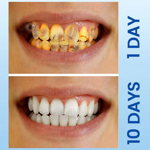 Ceoerty™ Deluxe Herbal Oral Care - Image 7