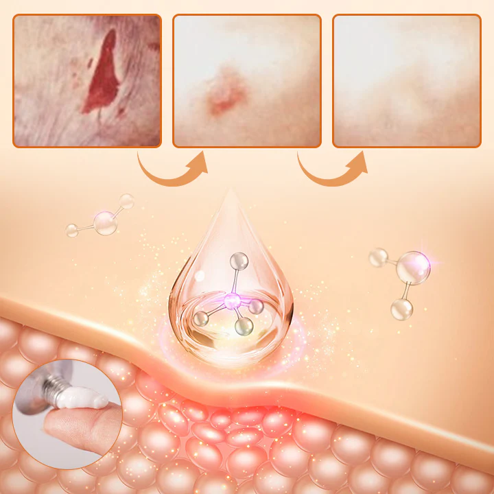 Diabetes Wound Strong Treatment Cream - Image 3