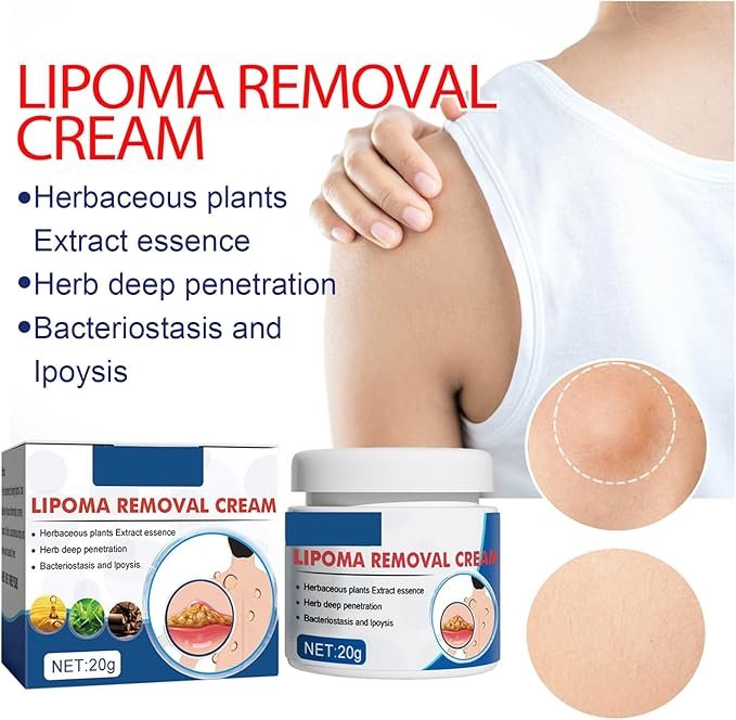 LIPOMA REMOVAL CREAM (IMPORTED) - Image 4