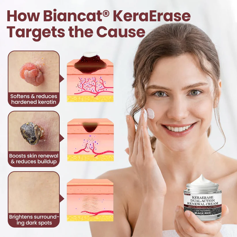 Biancat® KeraErase Dual-Action Renewal Cream - Image 2
