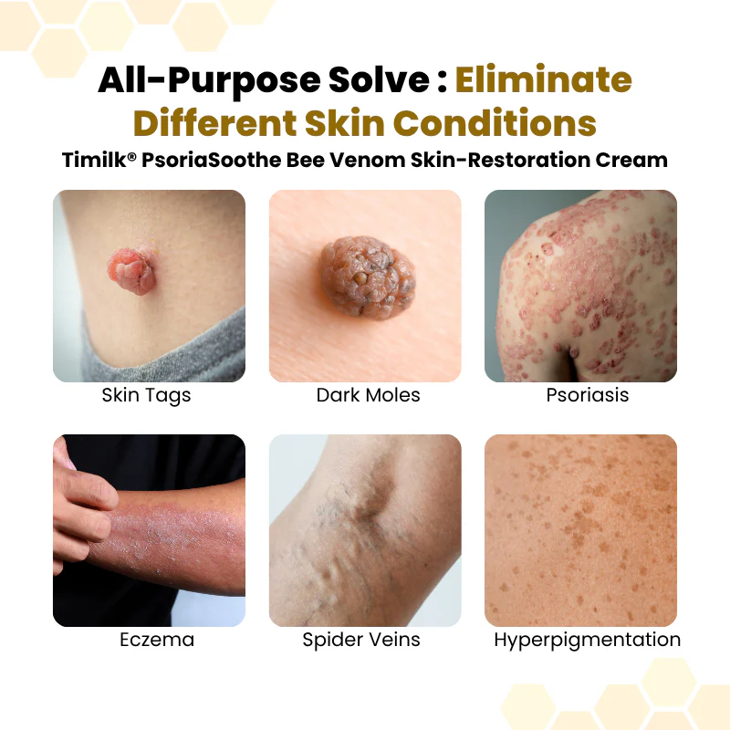 PsoriaSoothe Skin-Restoration Cream - Image 4