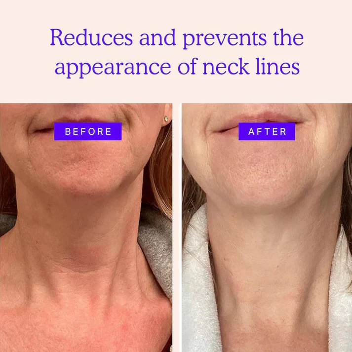 Magec Collagen Fullerene Neck Cream - Tightening & Anti-Wrinkle Formula - Image 11