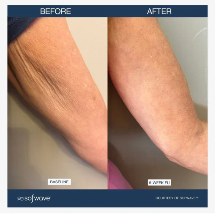 Magec Collagen Fullerene Neck Cream - Tightening & Anti-Wrinkle Formula - Image 10