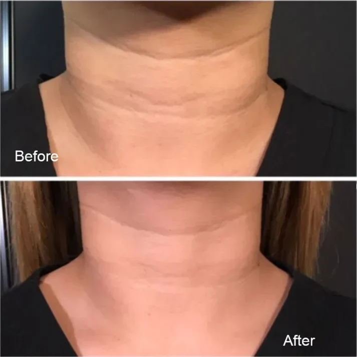 Magec Collagen Fullerene Neck Cream - Tightening & Anti-Wrinkle Formula - Image 9