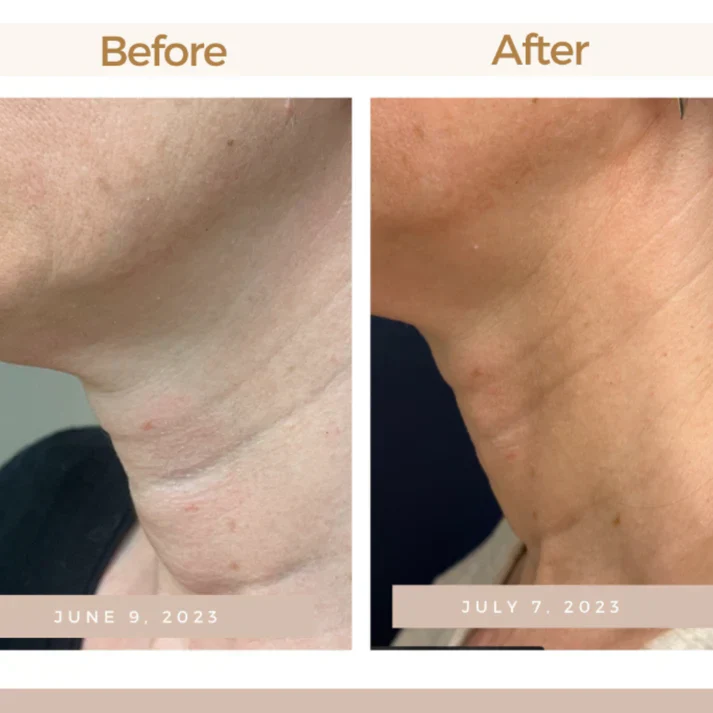 Magec Collagen Fullerene Neck Cream - Tightening & Anti-Wrinkle Formula - Image 7