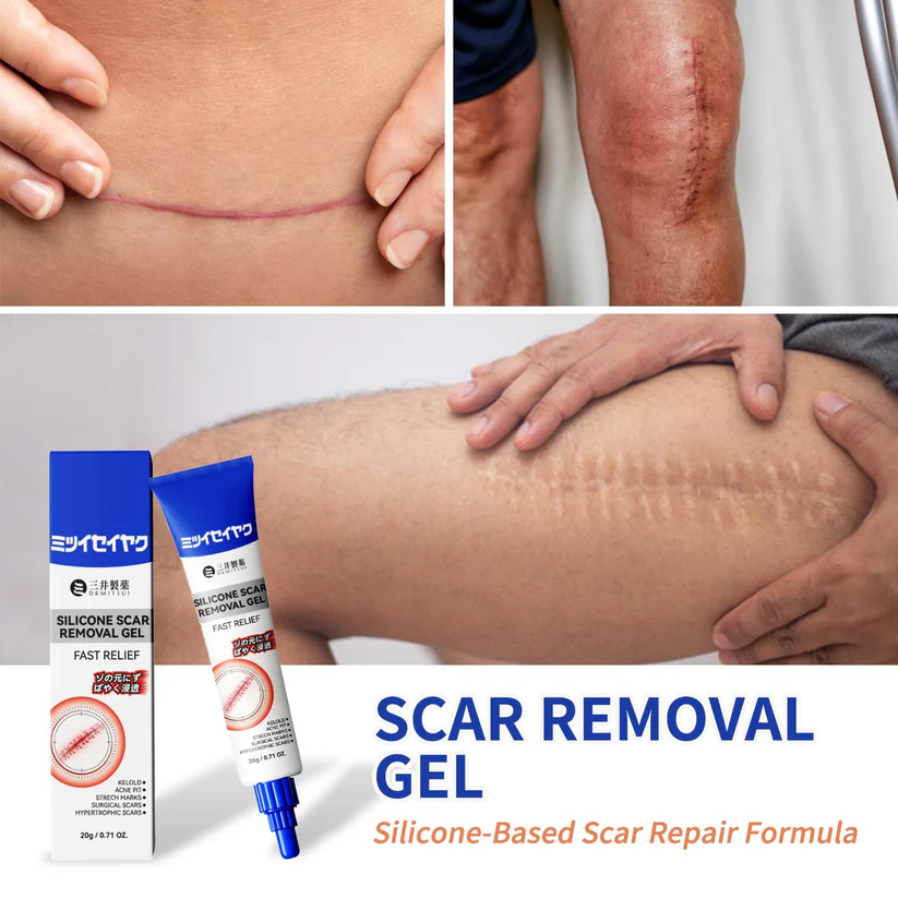 Scar Removal Gel for Old and New Scars - Image 8