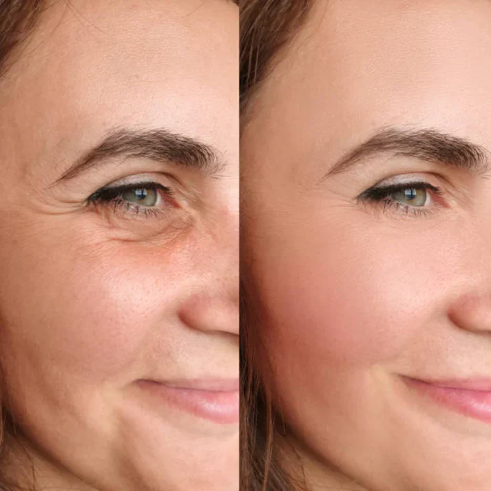 Magec Collagen Fullerene Neck Cream - Tightening & Anti-Wrinkle Formula - Image 19