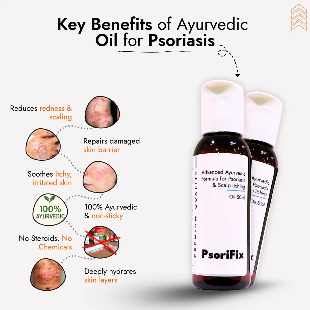 Natural Oil for Psoriasis & itching (for Day Use) - Image 8