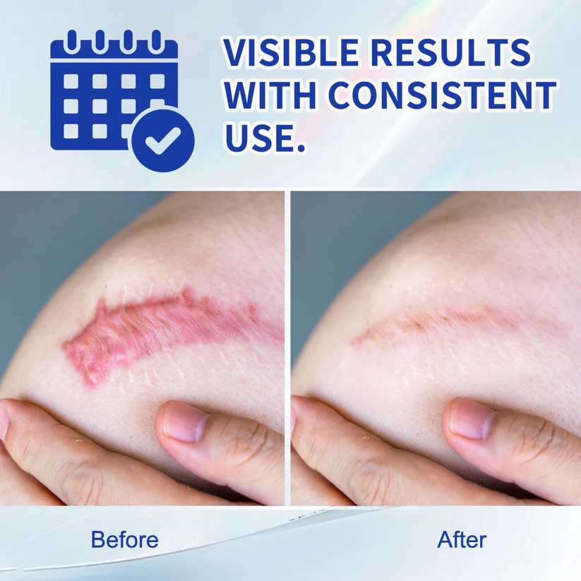 Scar Removal Gel for Old and New Scars - Image 10