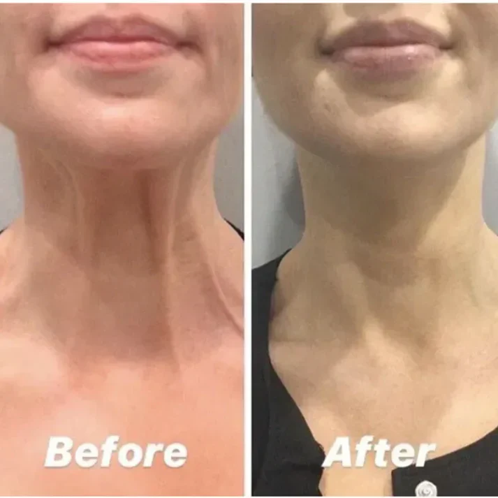 Magec Collagen Fullerene Neck Cream - Tightening & Anti-Wrinkle Formula - Image 14