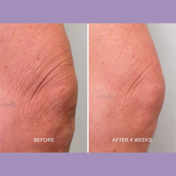 Magec Collagen Fullerene Neck Cream - Tightening & Anti-Wrinkle Formula - Image 13
